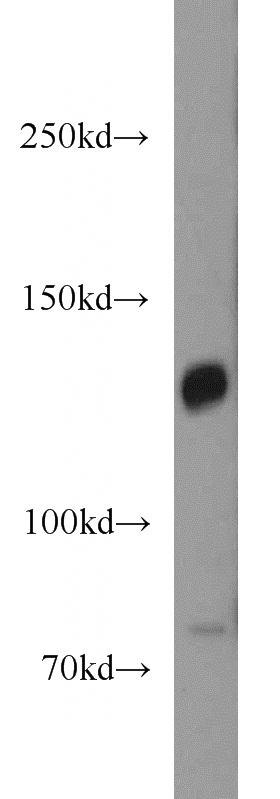 human brain tissue were subjected to SDS PAGE followed by western blot with Catalog No:113690(PCDH11X antibody) at dilution of 1:400