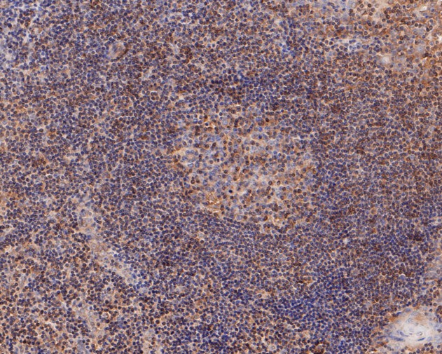 Fig2:; Immunohistochemical analysis of paraffin-embedded human tonsil tissue using anti-TMX4 antibody. The section was pre-treated using heat mediated antigen retrieval with Tris-EDTA buffer (pH 8.0-8.4) for 20 minutes.The tissues were blocked in 5% BSA for 30 minutes at room temperature, washed with ddH; 2; O and PBS, and then probed with the primary antibody ( 1/50) for 30 minutes at room temperature. The detection was performed using an HRP conjugated compact polymer system. DAB was used as the chromogen. Tissues were counterstained with hematoxylin and mounted with DPX.