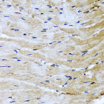 Immunohistochemistry - M6PR Polyclonal Antibody 