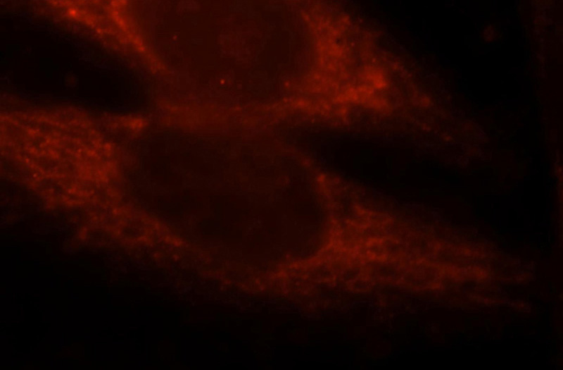 Immunofluorescent analysis of Hela cells, using TDRKH antibody Catalog No:115930 at 1:25 dilution and Rhodamine-labeled goat anti-rabbit IgG (red).