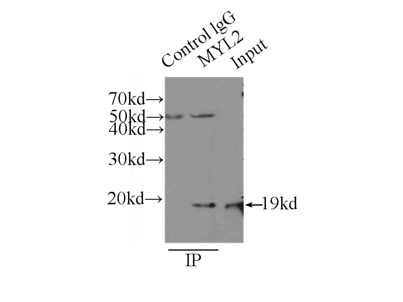 IP Result of anti-MYL2 (IP:Catalog No:112995, 3ug; Detection:Catalog No:112995 1:500) with mouse heart tissue lysate 6000ug.