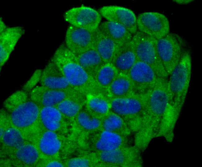 Fig3: ICC staining NaV1.7 in Hela cells (green). The nuclear counter stain is DAPI (blue). Cells were fixed in paraformaldehyde, permeabilised with 0.25% Triton X100/PBS.