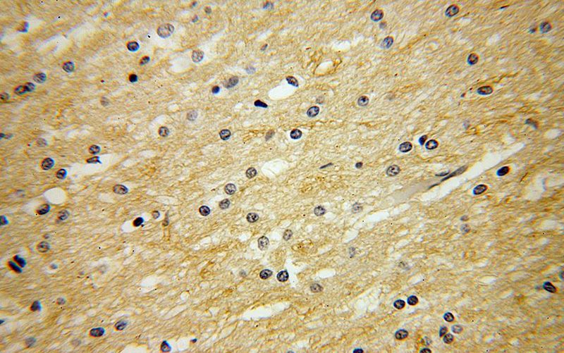Immunohistochemical of paraffin-embedded human brain using Catalog No:110965(GHITM antibody) at dilution of 1:50 (under 40x lens)