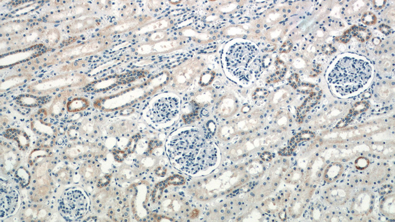 Immunohistochemistry of paraffin-embedded human kidney slide using Catalog No:112034(GLS Antibody) at dilution of 1:50