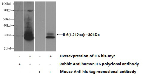 Transfected HEK-293 cells were subjected to SDS PAGE followed by western blot with Catalog No:111748(IL6 Antibody) at dilution of 1:1000