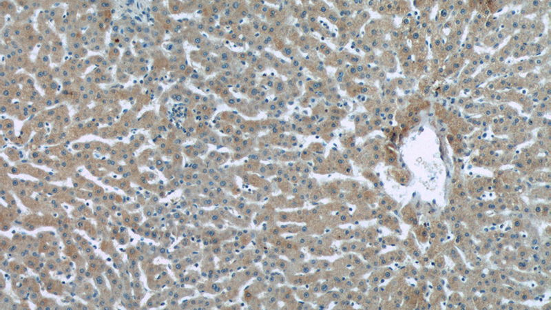 Immunohistochemistry of paraffin-embedded human liver tissue slide using Catalog No:114998(SOST Antibody) at dilution of 1:50 (under 10x lens)