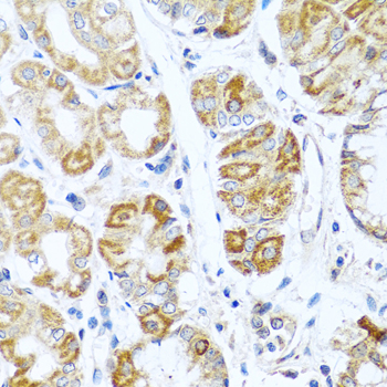 Immunohistochemistry - INHBC Polyclonal Antibody 