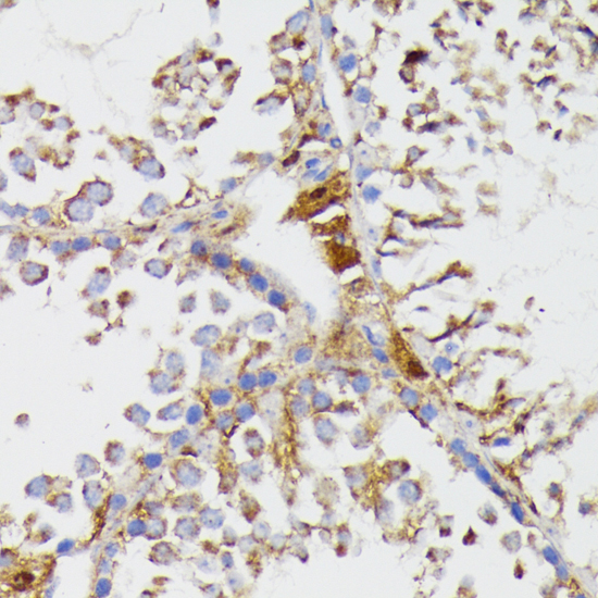 Immunohistochemistry - GALC Polyclonal Antibody 