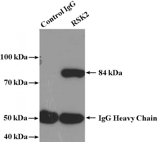 IP Result of anti-RPS6KA3 (IP:Catalog No:114845, 4ug; Detection:Catalog No:114845 1:1000) with K-562 cells lysate 4000ug.
