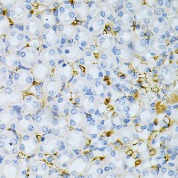 Immunohistochemistry - TAPBP Polyclonal Antibody 