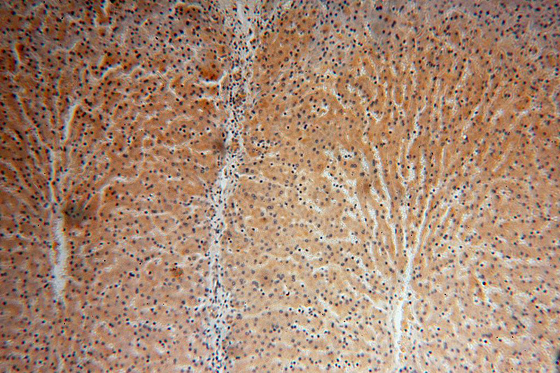 Immunohistochemical of paraffin-embedded human liver using Catalog No:112102(KLHL3 antibody) at dilution of 1:100 (under 10x lens)