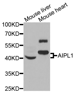 Western blot - AIPL1 Polyclonal Antibody 