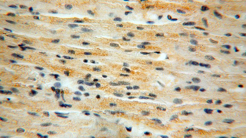 Immunohistochemical of paraffin-embedded human heart using Catalog No:117086(B3GALNT2 antibody) at dilution of 1:100 (under 40x lens)