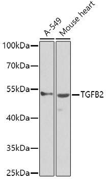 Western blot - TGFB2 Polyclonal Antibody 