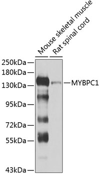 Western blot - MYBPC1 Polyclonal Antibody 