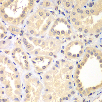 Immunohistochemistry - SPIN2B Polyclonal Antibody 