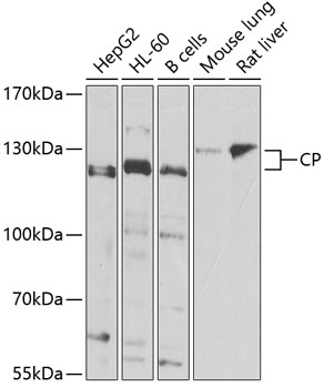 Western blot - CP Polyclonal Antibody 
