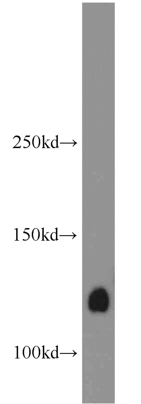Raji cells were subjected to SDS PAGE followed by western blot with Catalog No:109434(CNOT3 antibody) at dilution of 1:500