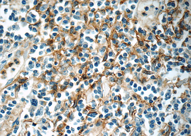 Immunohistochemistry of paraffin-embedded human tonsillitis slide using Catalog No:110320(ENOX1 Antibody) at dilution of 1:50