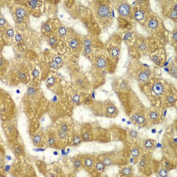 Immunohistochemistry - MYO1C Polyclonal Antibody 