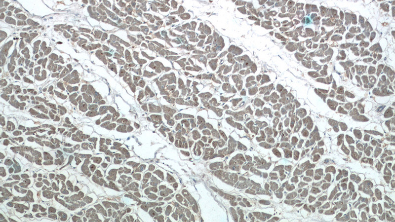 Immunohistochemistry of paraffin-embedded human heart tissue slide using Catalog No:113213(NPHP3 Antibody) at dilution of 1:50 (under 10x lens)