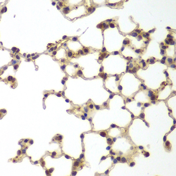 Immunohistochemistry - GSS Polyclonal Antibody 