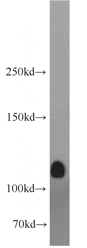 mouse brain tissue were subjected to SDS PAGE followed by western blot with Catalog No:109914(DGKQ antibody) at dilution of 1:800