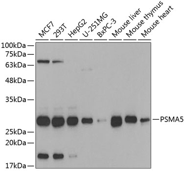 Western blot - PSMA5 Polyclonal Antibody 