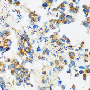 Immunohistochemistry - APOBEC3F Polyclonal Antibody 