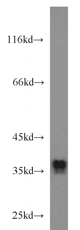 A2780 cells were subjected to SDS PAGE followed by western blot with Catalog No:115249(SIX1 antibody) at dilution of 1:800