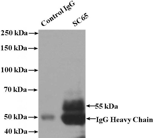 IP Result of anti-SC65 (IP:Catalog No:114981, 4ug; Detection:Catalog No:114981 1:500) with mouse bladder tissue lysate 3200ug.