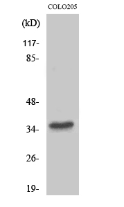 Fig1:; Western Blot analysis of various cells using T2R8 Polyclonal Antibody