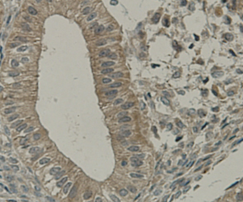 Fig8: Immunohistochemical analysis of paraffin-embedded human uterus muscle tissue using anti-TMEM177 antibody. Counter stained with hematoxylin.