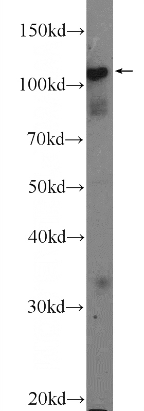 mouse testis tissue were subjected to SDS PAGE followed by western blot with Catalog No:115716(STK31 Antibody) at dilution of 1:600