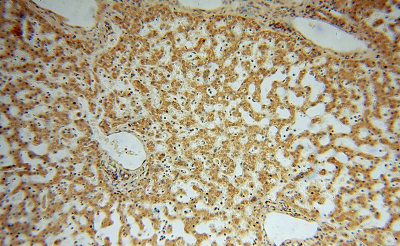 Immunohistochemical of paraffin-embedded human liver using Catalog No:110790(FUCA1 antibody) at dilution of 1:50 (under 10x lens)