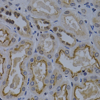 Immunohistochemistry - TNFRSF6B Polyclonal Antibody 