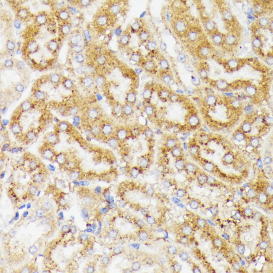 Immunohistochemistry - GALC Polyclonal Antibody 