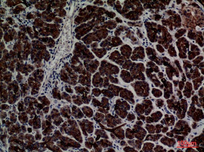 Fig2:; Immunohistochemical analysis of paraffin-embedded human-pancreas, antibody was diluted at 1:100