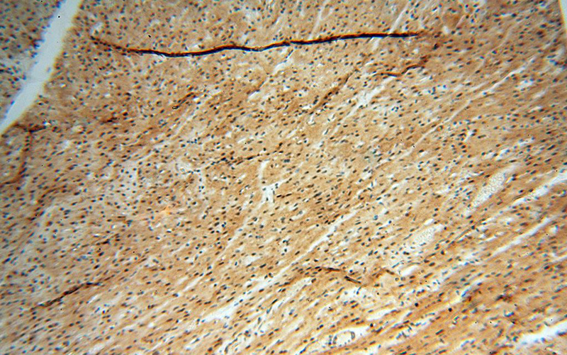 Immunohistochemical of paraffin-embedded human heart using Catalog No:111702(HSPB8 antibody) at dilution of 1:50 (under 10x lens)