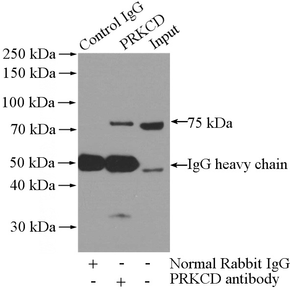 IP Result of anti-PRKCD (IP:Catalog No:113849, 4ug; Detection:Catalog No:113849 1:500) with A431 cells lysate 2000ug.