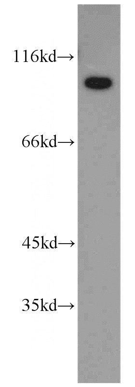 Y79 cells were subjected to SDS PAGE followed by western blot with Catalog No:115941(TELO2 antibody) at dilution of 1:1500