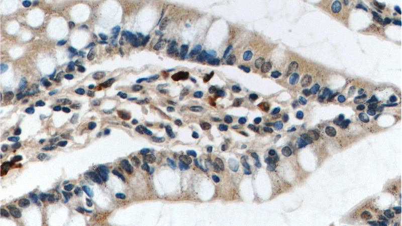 Immunohistochemistry of paraffin-embedded human small intestine tissue slide using Catalog No:112666(MKL1 Antibody) at dilution of 1:50 (under 40x lens)
