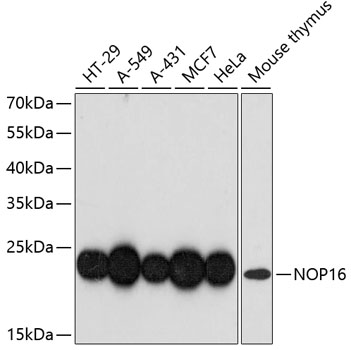 Western blot - NOP16 Polyclonal Antibody 