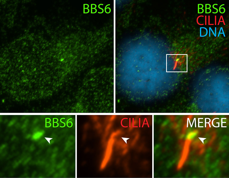 IF result (cytoplasm and the base of cilia stain) of anti-BBS6 (Catalog No:108373; 1:50) with hTERT-RPE1 cell (MeOH fixed) by Dr. Moshe Kim.
