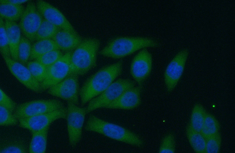 Immunofluorescent analysis of (10% Formaldehyde) fixed HeLa cells using Catalog No:114493(RABEP1 Antibody) at dilution of 1:50 and Alexa Fluor 488-congugated AffiniPure Goat Anti-Rabbit IgG(H+L)