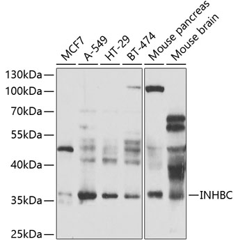 Western blot - INHBC Polyclonal Antibody 