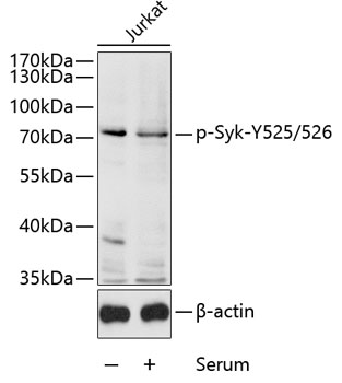 Western blot - Phospho-Syk-Y525/526 pAb 