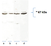 WB result of Catalog No:108883 from Dilwar in Rat tissue. Rat brain (a), heart (b) liver (c) mitochondria and liver homogenate (d), (40 ug with 10% PAGE) probed with 1:1000 dilution.