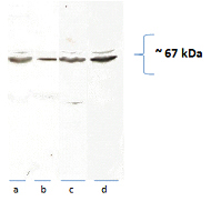 WB result of Catalog No:108883 from Dilwar in Rat tissue. Rat brain (a), heart (b) liver (c) mitochondria and liver homogenate (d), (40 ug with 10% PAGE) probed with 1:1000 dilution.