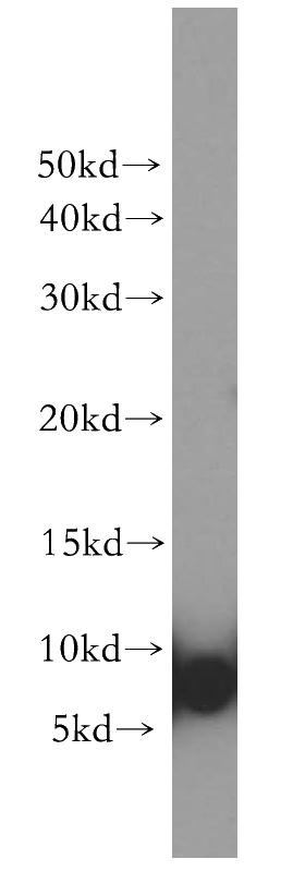 A2780 cells were subjected to SDS PAGE followed by western blot with Catalog No:114960(S100A3 antibody) at dilution of 1:300